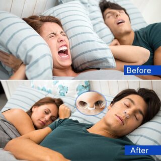 Anti-Snoring  Nasal Dilator & Mouth Guard